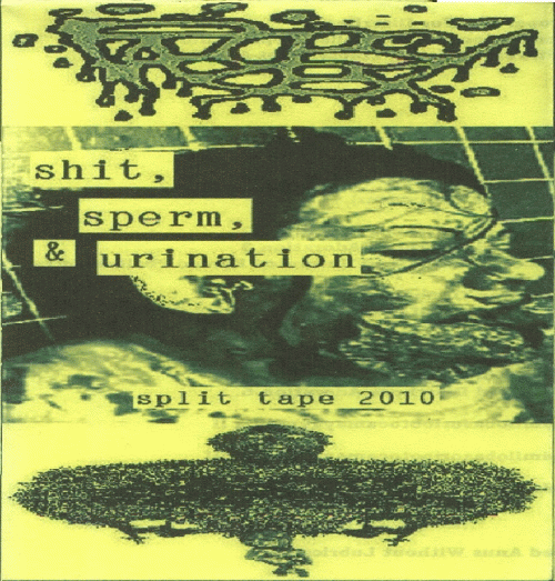 Urinary Tract Infection From Severe Pus Clots : Shit, Sperm & Urination Split Tape 2010